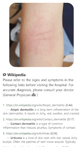 Download Model Dermatol Terbaru – Cek Penyakit Kulit Gratis description image 13