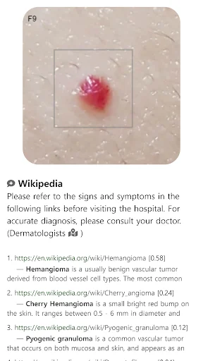 Download Model Dermatol Terbaru – Cek Penyakit Kulit Gratis description image 11