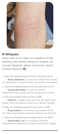 Download Model Dermatol Terbaru – Cek Penyakit Kulit Gratis description image 7