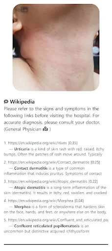 Download Model Dermatol Terbaru – Cek Penyakit Kulit Gratis description image 6