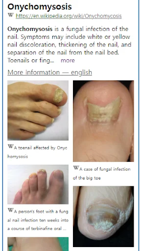 Download Model Dermatol Terbaru – Cek Penyakit Kulit Gratis description image 2