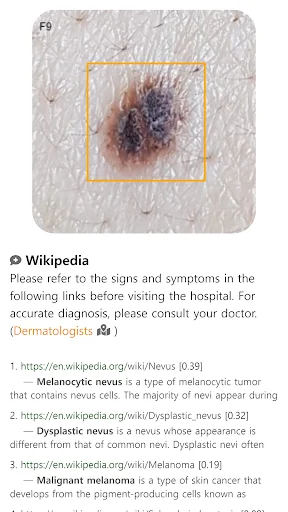 Download Model Dermatol Terbaru – Cek Penyakit Kulit Gratis description image 9