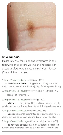 Download Model Dermatol Terbaru – Cek Penyakit Kulit Gratis description image 4
